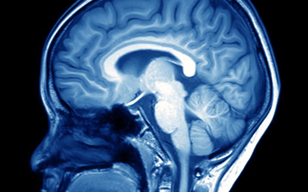 Spinal Muscular Atrophy mid-December Roundup: MRI Patterns, Sam68 & More