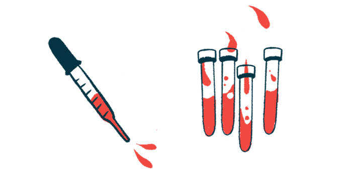 Blood is shown in vials and in a pipette.