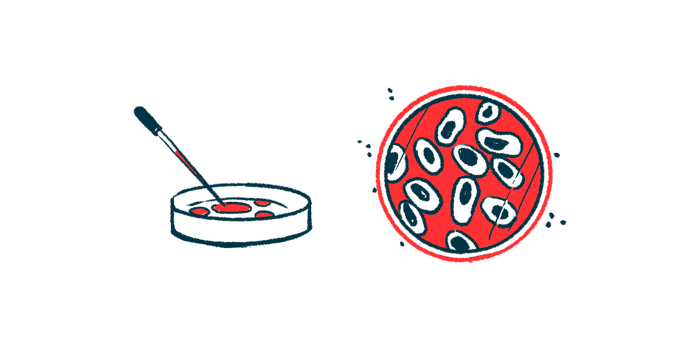 SMA types | SMA News Today | biomarkers | cells in lab dish illustration
