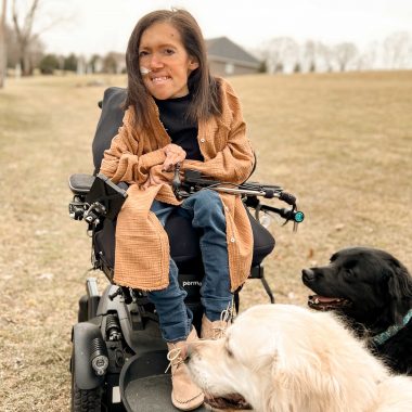 health | SMA News Today | photograph of a young woman (Alyssa) in a wheelchair, with her two dogs at bottom right
