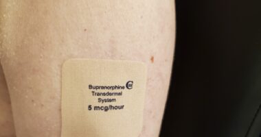 A Bupenorphine transdermal patch is shown on someone's arm