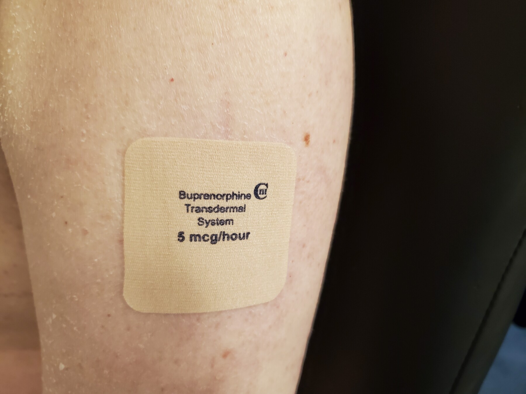 A Bupenorphine transdermal patch is shown on someone's arm