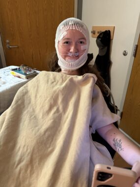 A woman has multiple wires and electrodes attached to her head, which are secured by a white mesh head wrap. A blanket is covering her body, and she appears to be inside of a hospital room.